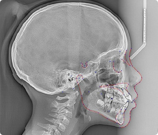 シームレスに優れたデジタルスキャン性能を備えた最新の設備