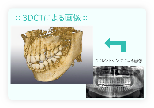 先進の３DCTや専門機器を用いた高度な精密検査